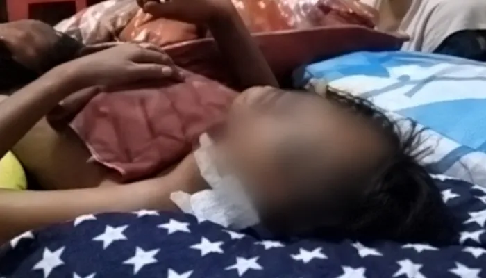 Viral Video Dugaan Penganiayaan Santri di Pamekasan, Korban Alami Luka Berat